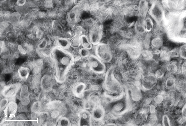 SEM image of an area of the mouse spinal cord resin-section