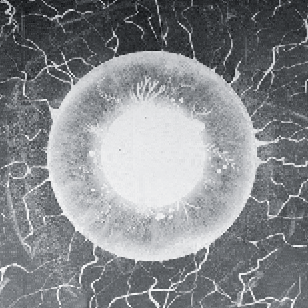 SEM image of 3D grey scale lithography