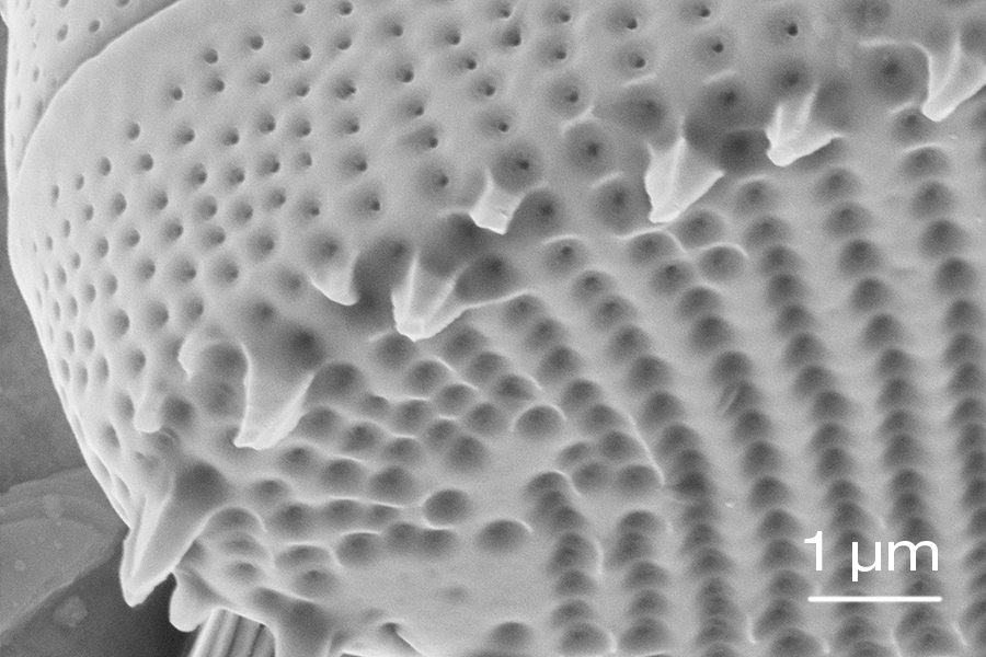 Lithium ion image of a diatom