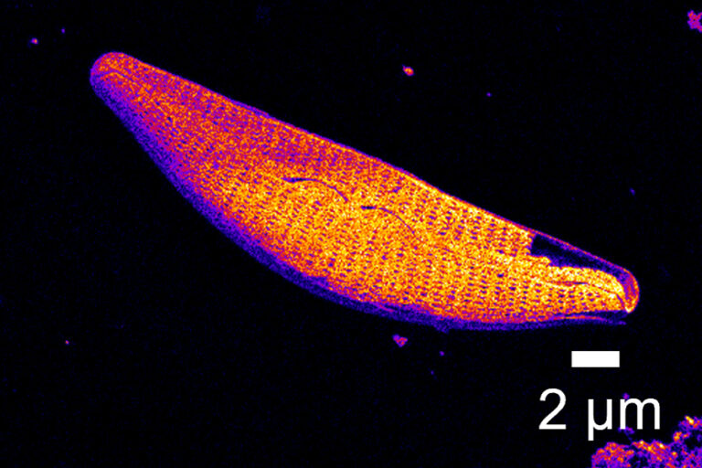 SIMS image of a diatom composed of Si and SiO2 signal multiplexing